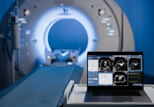 ブラックボックス最適化による偏微分方程式の逆問題解析